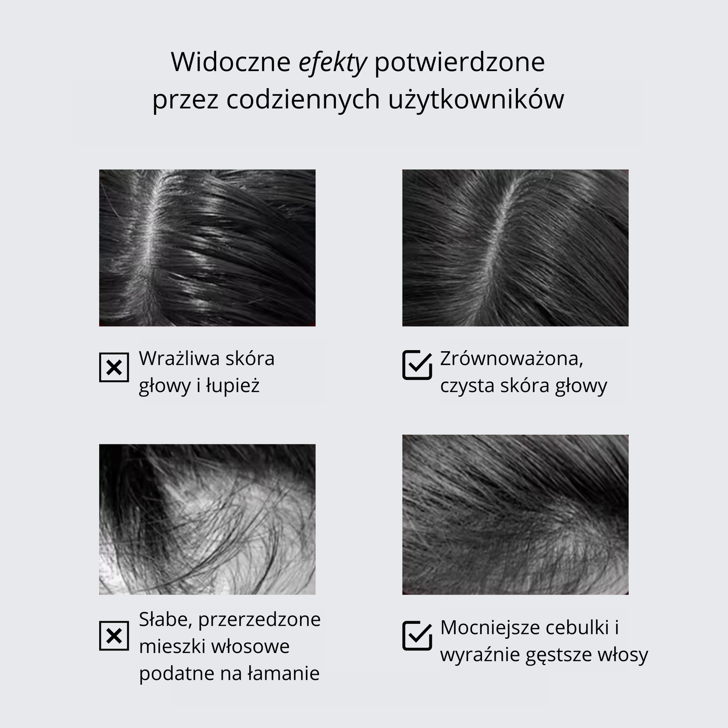 Szczotka Stymulująca Wzrost Włosów 3W1