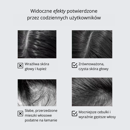 Szczotka Stymulująca Wzrost Włosów 3W1